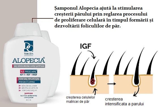 Alopecia, IGF, Sampon Anticadere Par cu Procapil 3%, 300ML - poza 4