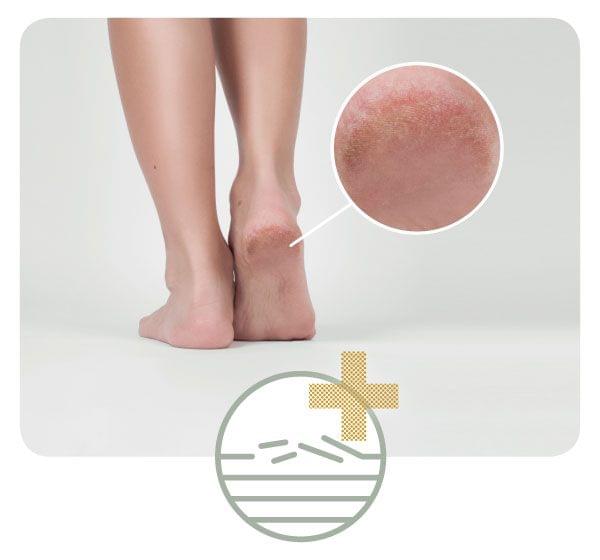 Crema calcaie crapate, piele crapata, aspra - crema cu miere de Manuka (50ml) - poza 3